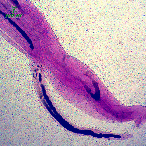 辽宁日本血吸虫雌雄合抱装片