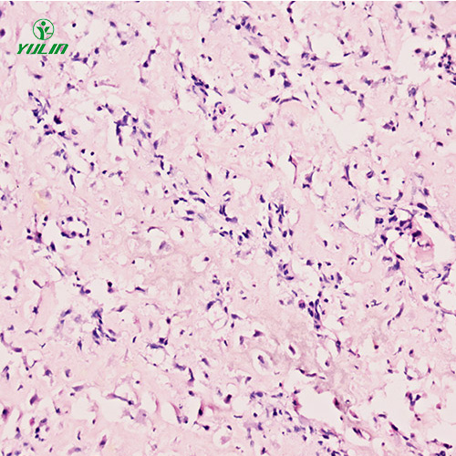辽宁人肌肉骨骼系统疾病标本片