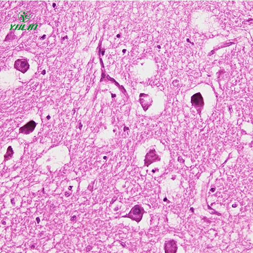 辽宁人神经系统疾病标本片