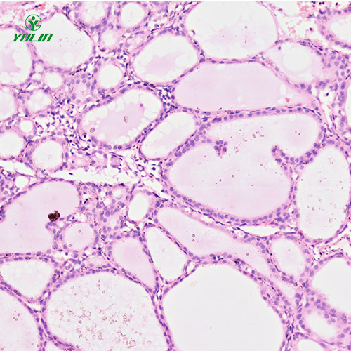 辽宁人内分泌系统疾病标本片