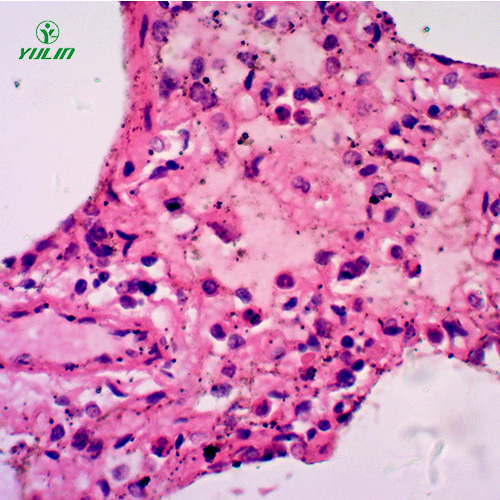 辽宁人呼吸系统疾病标本片
