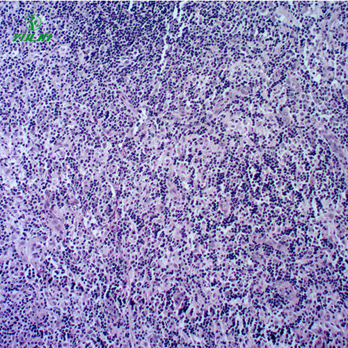 辽宁人体免疫性疾病切片