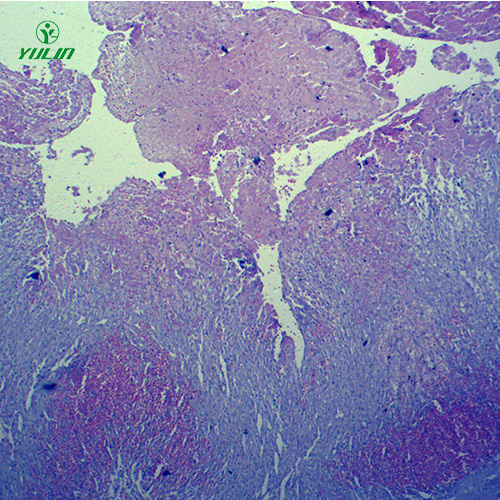 辽宁人体局部血液循环障碍病理玻片