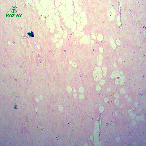 辽宁人体细胞组织损伤病理切片