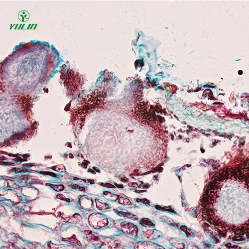 辽宁水果病害标本片