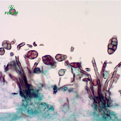 辽宁茄科植物病害玻片