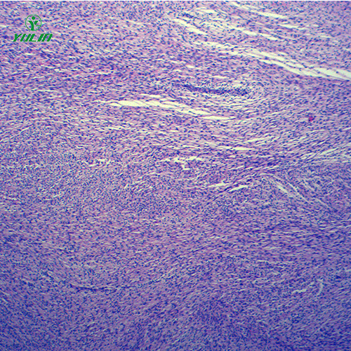 辽宁人体肿瘤病理玻片