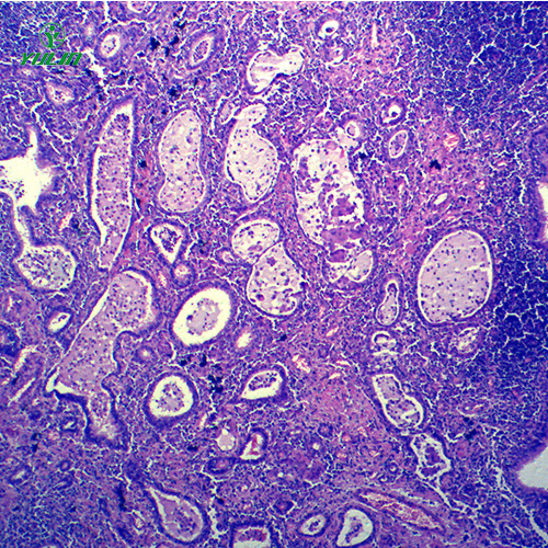 辽宁炎症病理玻片